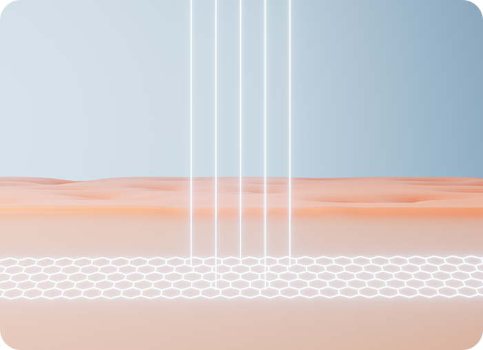 Vaginal rejuvenation의 원리